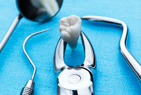 Хирургическое лечение зуба